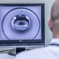 TMS, magnetische hersenstimulatie, stemmingsstoornissen , autisme, antisociaal gedrag, MRI-scan, hersenscan, wetenschappers, ECT, onderzoek, obesitas, deep brainstimulation, diepe hersenstimulatie