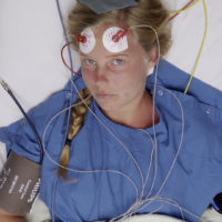 RCT, ECT, elektroconvulsietherapie