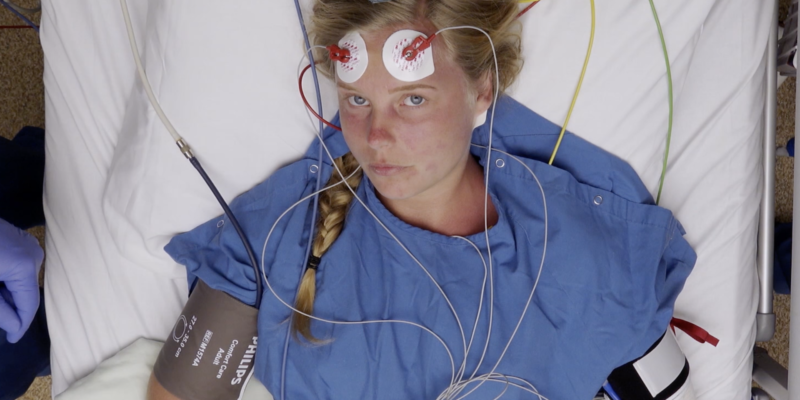 RCT, ECT, elektroconvulsietherapie
