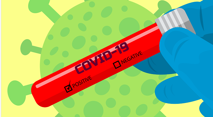 CORONA-TEST, coronacrisis