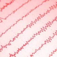 EEG, autisme, mentale vaardigheden, Gilles de la Tourettes, EEG, TMS, OCD, hersenactiviteit