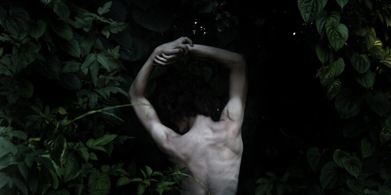 Body Dymorphic Disorder