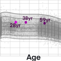 brein, hersenen, groeidiagrammen, amagdyla