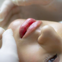 cosmetische chirurgie